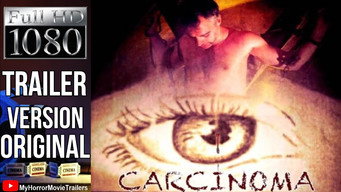#25 Carcinoma