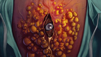 #4 Cyst