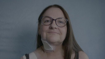 Hole in The Face