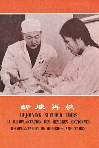 断肢再植 (1972年)のポスター画像 - FindKey