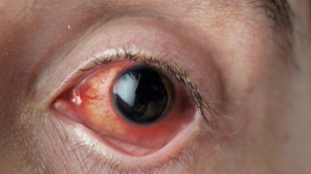 Eye Am (2013)