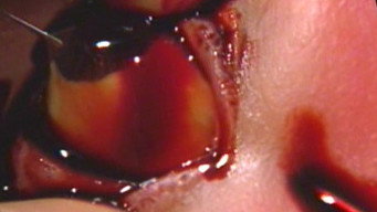 Escena 2 de Guinea Pig: Devil's experiment