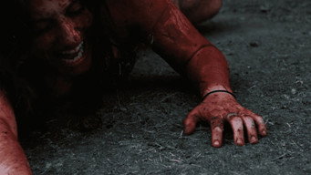 #2 The Scrotum