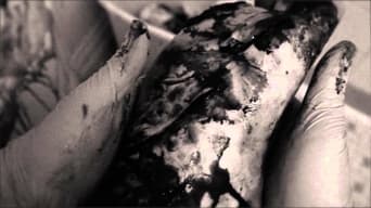 #1 Lung II
