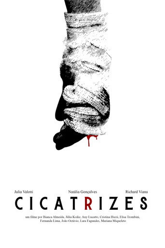 Cicatrizes