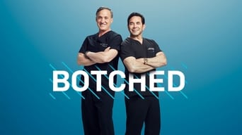 #2 Botched