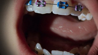 Open Wide (2024)