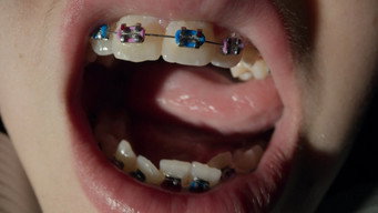 #5 Open Wide