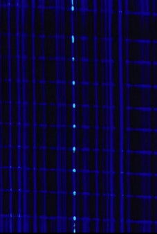 L’effet Bolduc poster