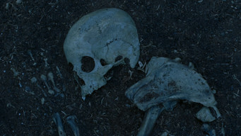 Bones media image