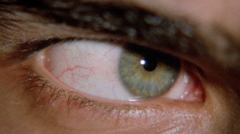 The Bloodstained Shadow (1978)