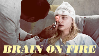 Galeria 3 - Brain on Fire