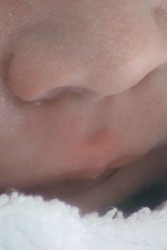 C-Section