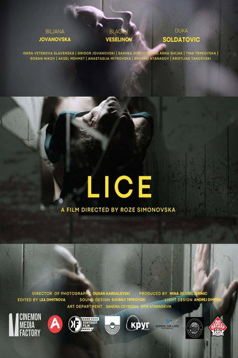 Lice