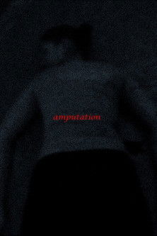 Amputation