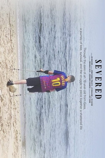Severed: The Story of a Boy from Gaza