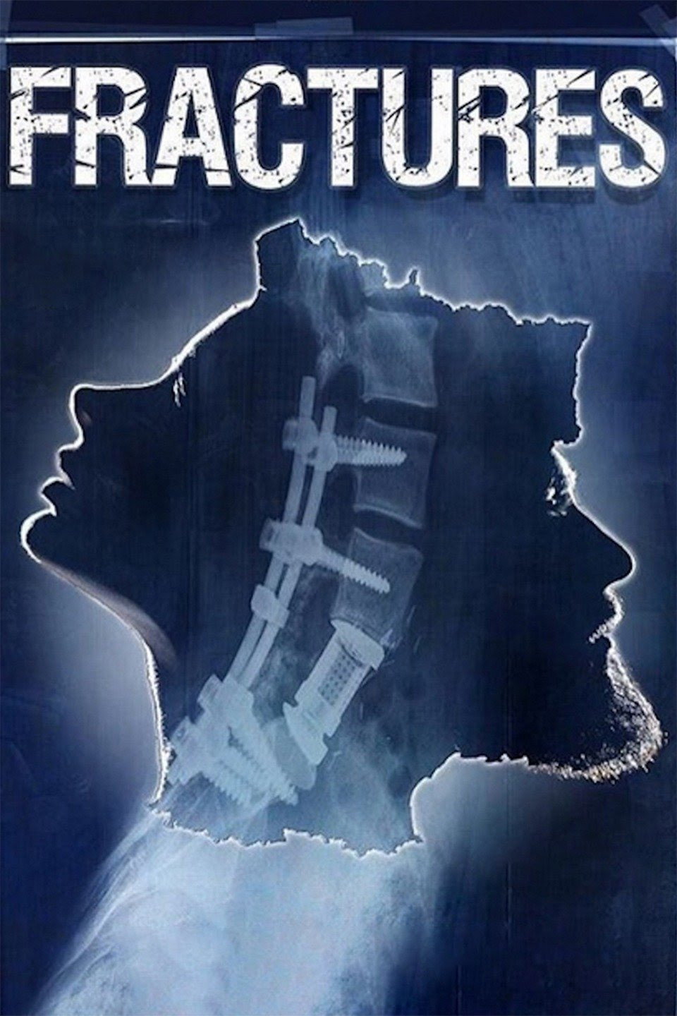 Fractures (2017) poster
