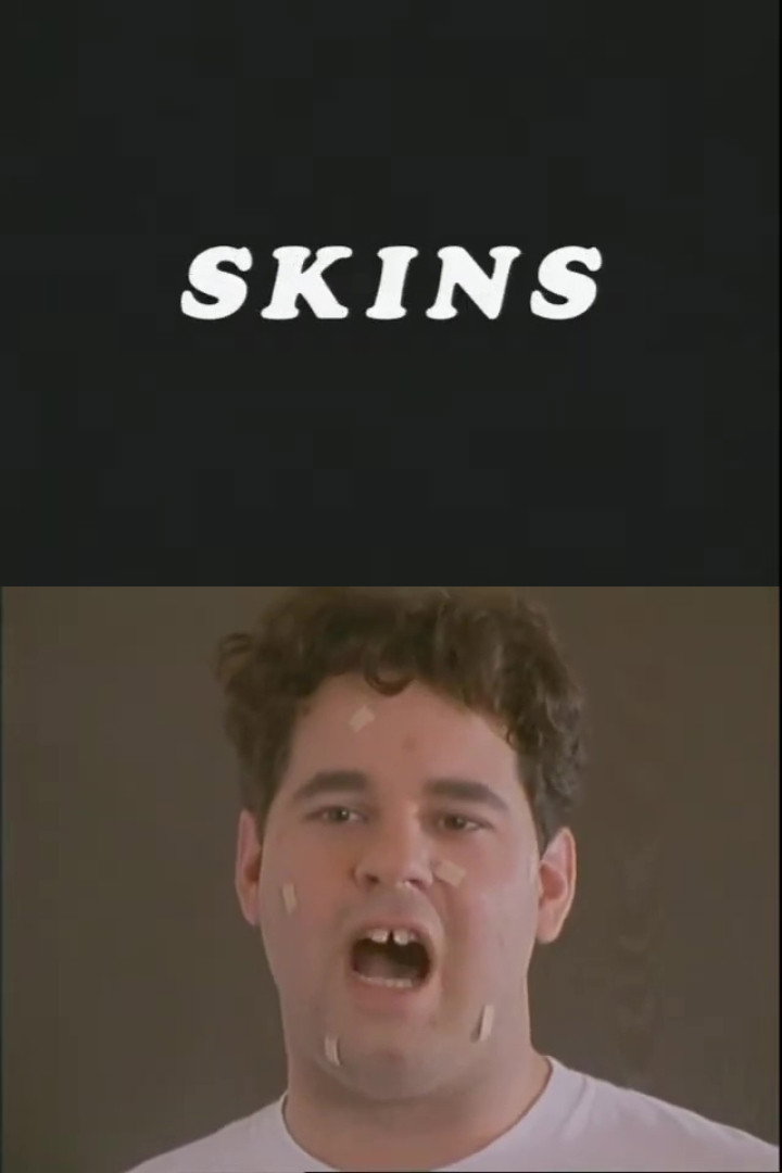 Skins (1997) poster
