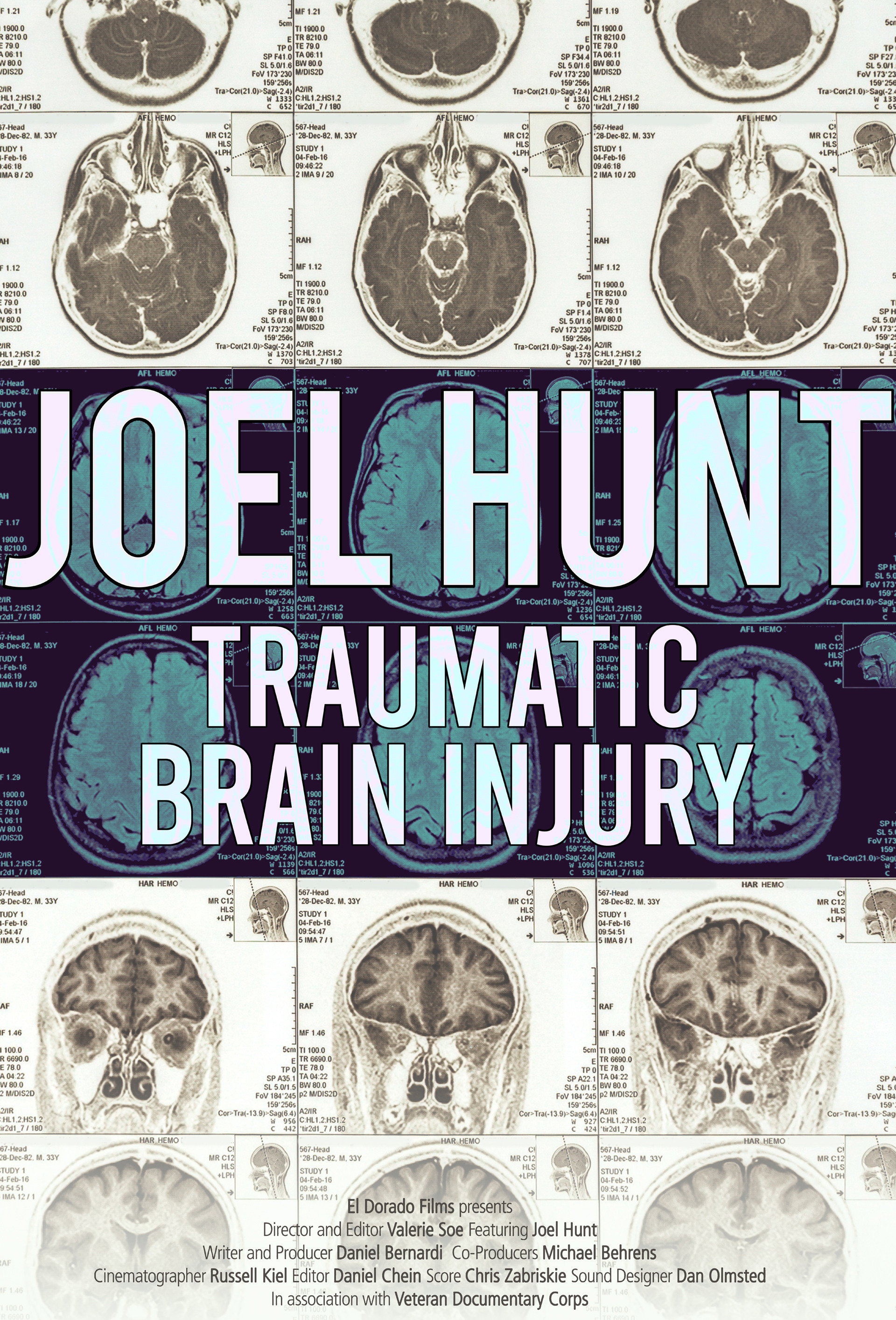 Joel Hunt: Traumatic Brain Injury (TBI) (2015) poster