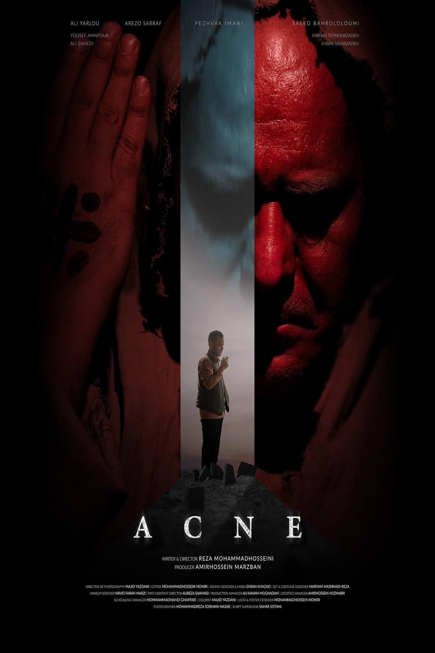 Acne (2025) poster