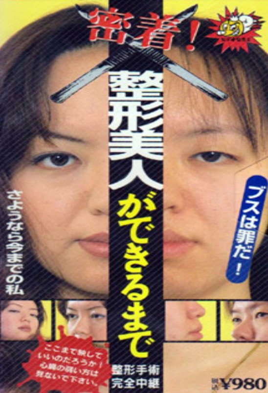 Until You Have  Beauty: Plastic Surgery (1995) poster