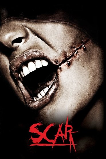 Scar