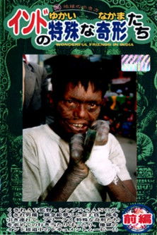 India's Unique Deformed Creatures (The Curious Companions) Part 1