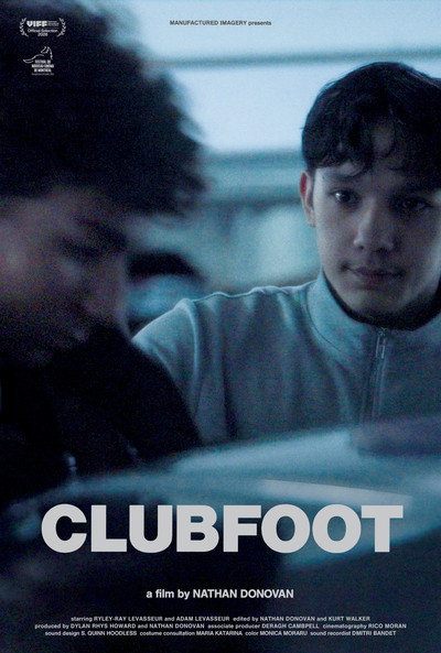 Clubfoot