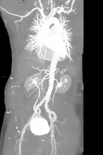 Poster do Filme X-Ray Eros