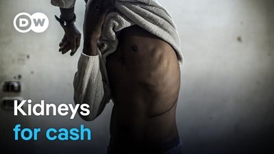The global organ trafficking network