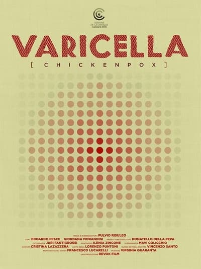 Varicella