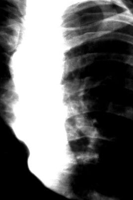 Poster do Filme Tear Gas