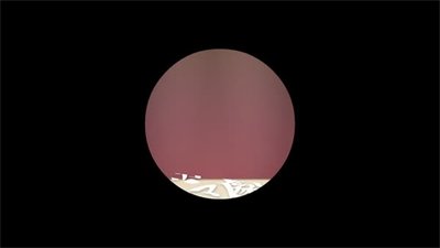 Епизод 11