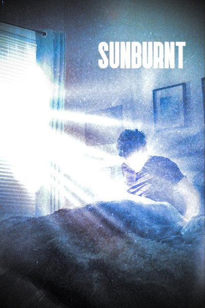 Sunburnt