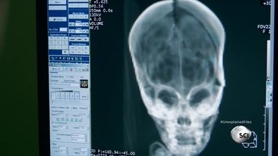 Peruvian Alien Skull & Baltic Sea UFO