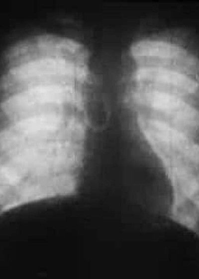 Watch Now!Roentgenfilm II Full MoviePutlockers-HD