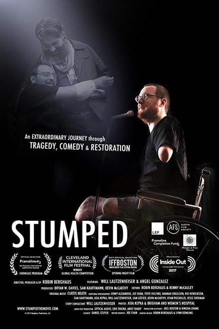 Stumped