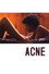 Acné