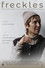 Freckles