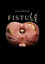 FISTULE