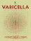 Varicella