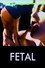Fetal