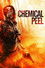 Chemical Peel