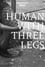 Human with three legs photo