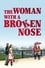 The Woman with a Broken Nose photo