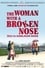 The Woman with a Broken Nose photo