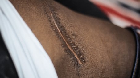 Exposing the Illegal Organ Trade (2020) - Episode 35 poster and promotional image