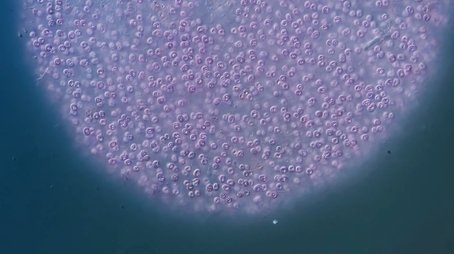 The Purple Bacteria That Are Afraid of Oxygen (2021) - Episode 4 poster and promotional image