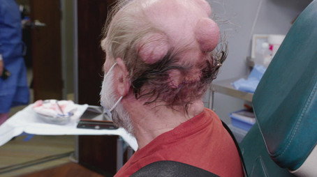 Dr. Pimple Popper, la dottoressa schiacciabrufoli Stagione 5