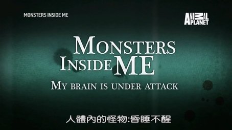 My Brain Is Under Attack (2017) - Episode 2 poster and promotional image